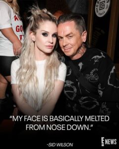 Slipknot’s Sid Wilson in Hospital with “Serious burns” as Girlfriend